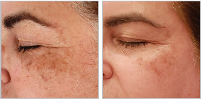 FF3 Triple Repair Complex